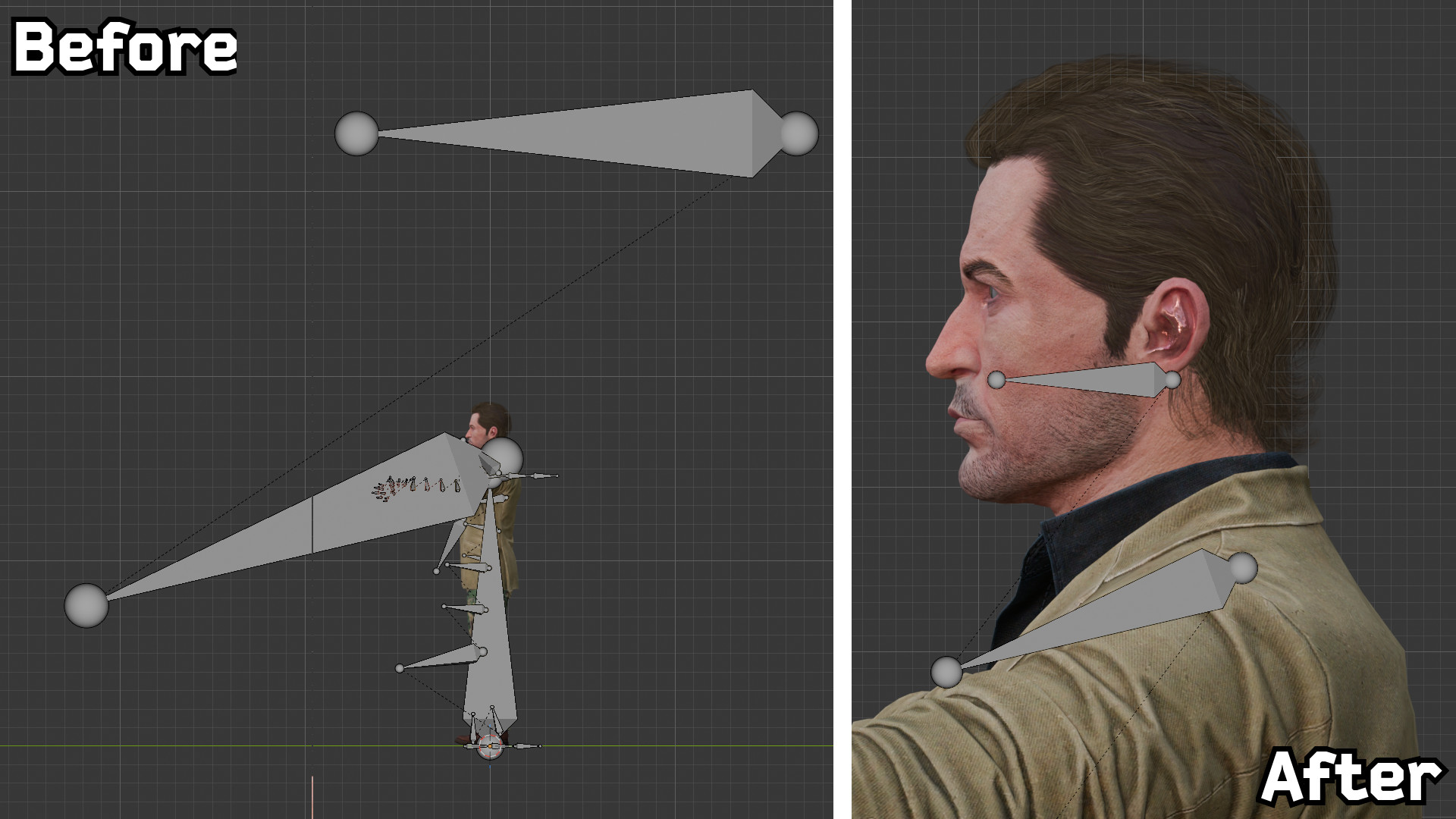 fixing the bones