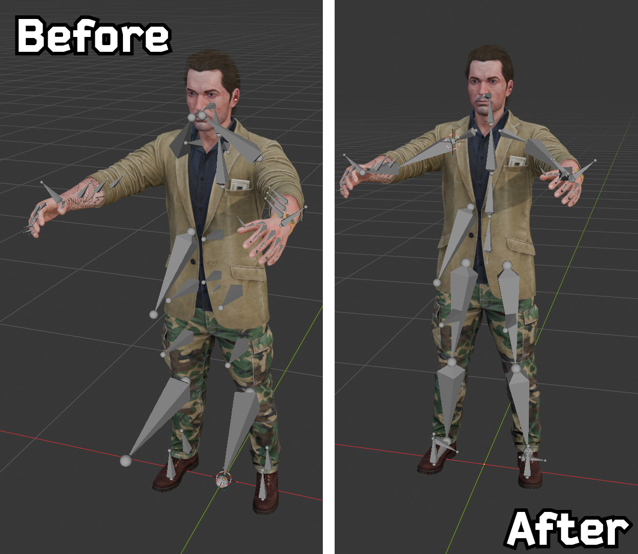 bones fixed